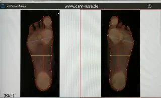 Computerscan Fußsohle